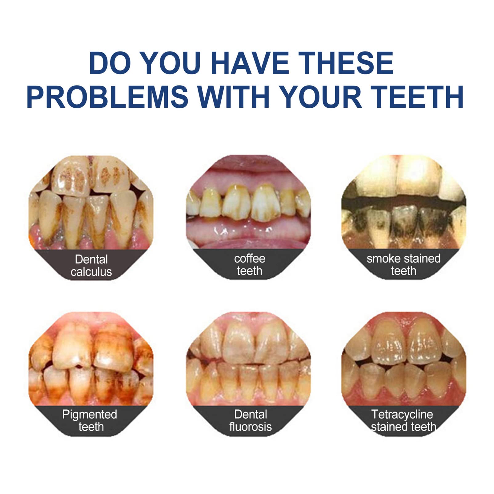 BBOJI Gentle Smile Toothpaste